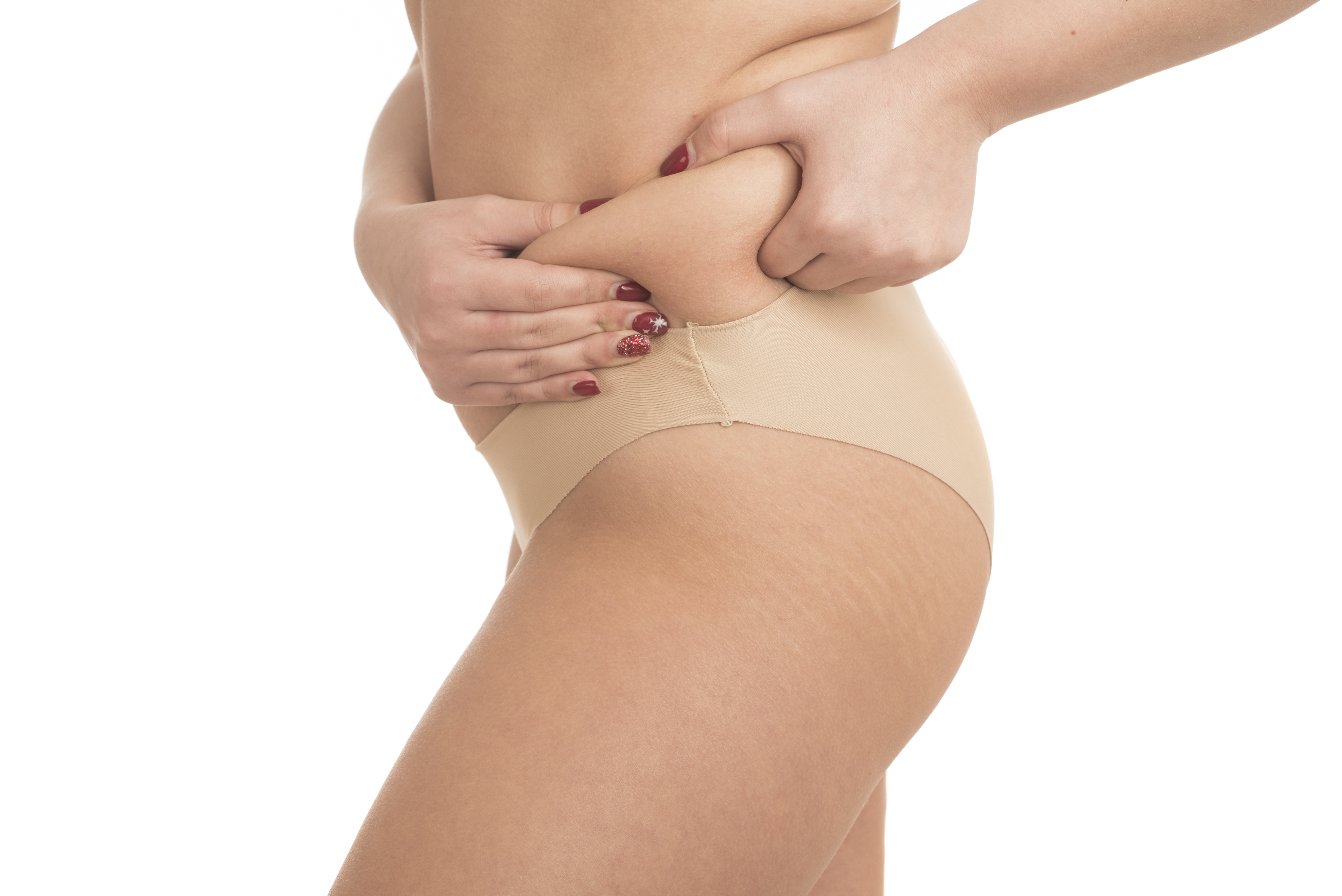 Lipedema
